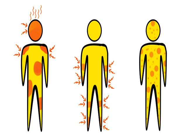 Příznaky a diagnostika vyrážky ze solárka